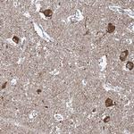 WHAMM Antibody in Immunohistochemistry (Paraffin) (IHC (P))