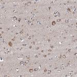 LIPT2 Antibody in Immunohistochemistry (Paraffin) (IHC (P))