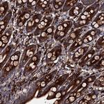 LIPT2 Antibody in Immunohistochemistry (Paraffin) (IHC (P))