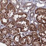 LIPT2 Antibody in Immunohistochemistry (Paraffin) (IHC (P))