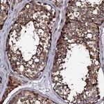 LIPT2 Antibody in Immunohistochemistry (Paraffin) (IHC (P))