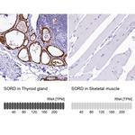 Sorbitol Dehydrogenase Antibody in Immunohistochemistry (IHC)