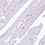 Sorbitol Dehydrogenase Antibody in Immunohistochemistry (IHC)