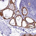 Sorbitol Dehydrogenase Antibody in Immunohistochemistry (IHC)