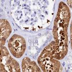 Sorbitol Dehydrogenase Antibody in Immunohistochemistry (IHC)