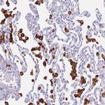 PLBD1 Antibody in Immunohistochemistry (IHC)