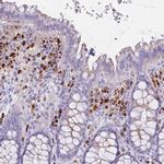 PLBD1 Antibody in Immunohistochemistry (IHC)