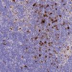 PLBD1 Antibody in Immunohistochemistry (IHC)