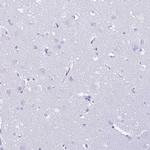 PLBD1 Antibody in Immunohistochemistry (IHC)