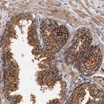 COG3 Antibody in Immunohistochemistry (Paraffin) (IHC (P))