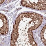 RAPGEF3 Antibody in Immunohistochemistry (Paraffin) (IHC (P))