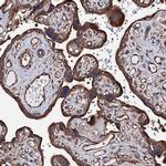 CKAP5 Antibody in Immunohistochemistry (IHC)