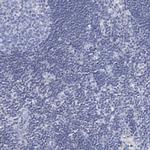 TOX3 Antibody in Immunohistochemistry (Paraffin) (IHC (P))