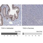 TOX3 Antibody in Immunohistochemistry (IHC)