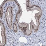 TOX3 Antibody in Immunohistochemistry (IHC)