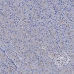 TOX3 Antibody in Immunohistochemistry (IHC)