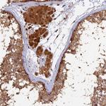 MNS1 Antibody in Immunohistochemistry (Paraffin) (IHC (P))