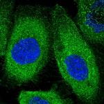 KLC2 Antibody in Immunocytochemistry (ICC/IF)