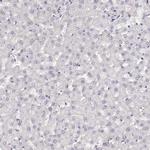 NUTM1 Antibody in Immunohistochemistry (IHC)