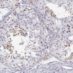 NUTM1 Antibody in Immunohistochemistry (IHC)