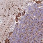 C2CD3 Antibody in Immunohistochemistry (Paraffin) (IHC (P))