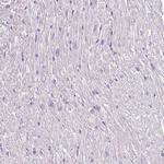 C2CD3 Antibody in Immunohistochemistry (Paraffin) (IHC (P))