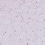 C2CD3 Antibody in Immunohistochemistry (Paraffin) (IHC (P))