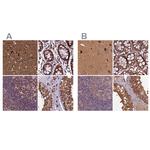 KLC2 Antibody in Immunohistochemistry (IHC)