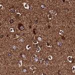 KLC2 Antibody in Immunohistochemistry (IHC)