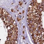 KLC2 Antibody in Immunohistochemistry (IHC)