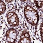 KLC2 Antibody in Immunohistochemistry (IHC)