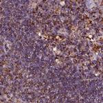 KLC2 Antibody in Immunohistochemistry (IHC)