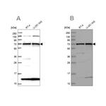 KLC2 Antibody in Western Blot (WB)