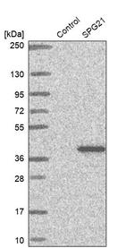 SPG21 Antibody in Western Blot (WB)