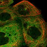 JLP Antibody in Immunocytochemistry (ICC/IF)