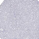 JLP Antibody in Immunohistochemistry (Paraffin) (IHC (P))