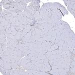 JLP Antibody in Immunohistochemistry (Paraffin) (IHC (P))