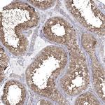 JLP Antibody in Immunohistochemistry (Paraffin) (IHC (P))