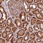 ST3GAL1 Antibody in Immunohistochemistry (Paraffin) (IHC (P))