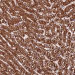 ST3GAL1 Antibody in Immunohistochemistry (Paraffin) (IHC (P))