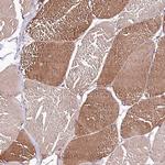 ST3GAL1 Antibody in Immunohistochemistry (Paraffin) (IHC (P))