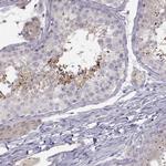 ACSL6 Antibody in Immunohistochemistry (IHC)