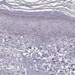 ACSL6 Antibody in Immunohistochemistry (IHC)