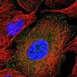 Kindlin 2 Antibody in Immunocytochemistry (ICC/IF)