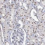 SNRPD1 Antibody in Immunohistochemistry (Paraffin) (IHC (P))