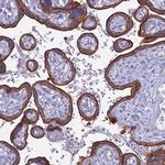 MYO5B Antibody in Immunohistochemistry (IHC)