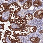 MYO5B Antibody in Immunohistochemistry (IHC)