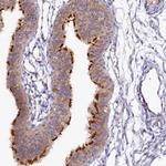 FOPNL Antibody in Immunohistochemistry (Paraffin) (IHC (P))