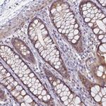 FOPNL Antibody in Immunohistochemistry (Paraffin) (IHC (P))