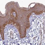 FOPNL Antibody in Immunohistochemistry (Paraffin) (IHC (P))